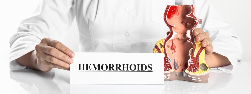 What are external hemorrhoids?
