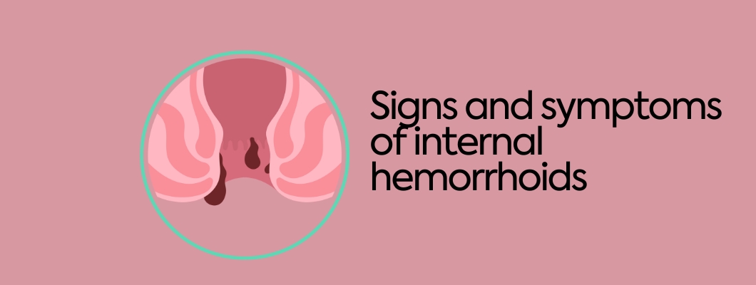 Signs and symptoms of internal hemorrhoids