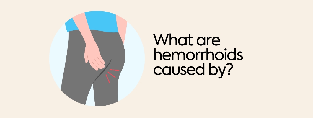 What are hemorrhoids caused by?