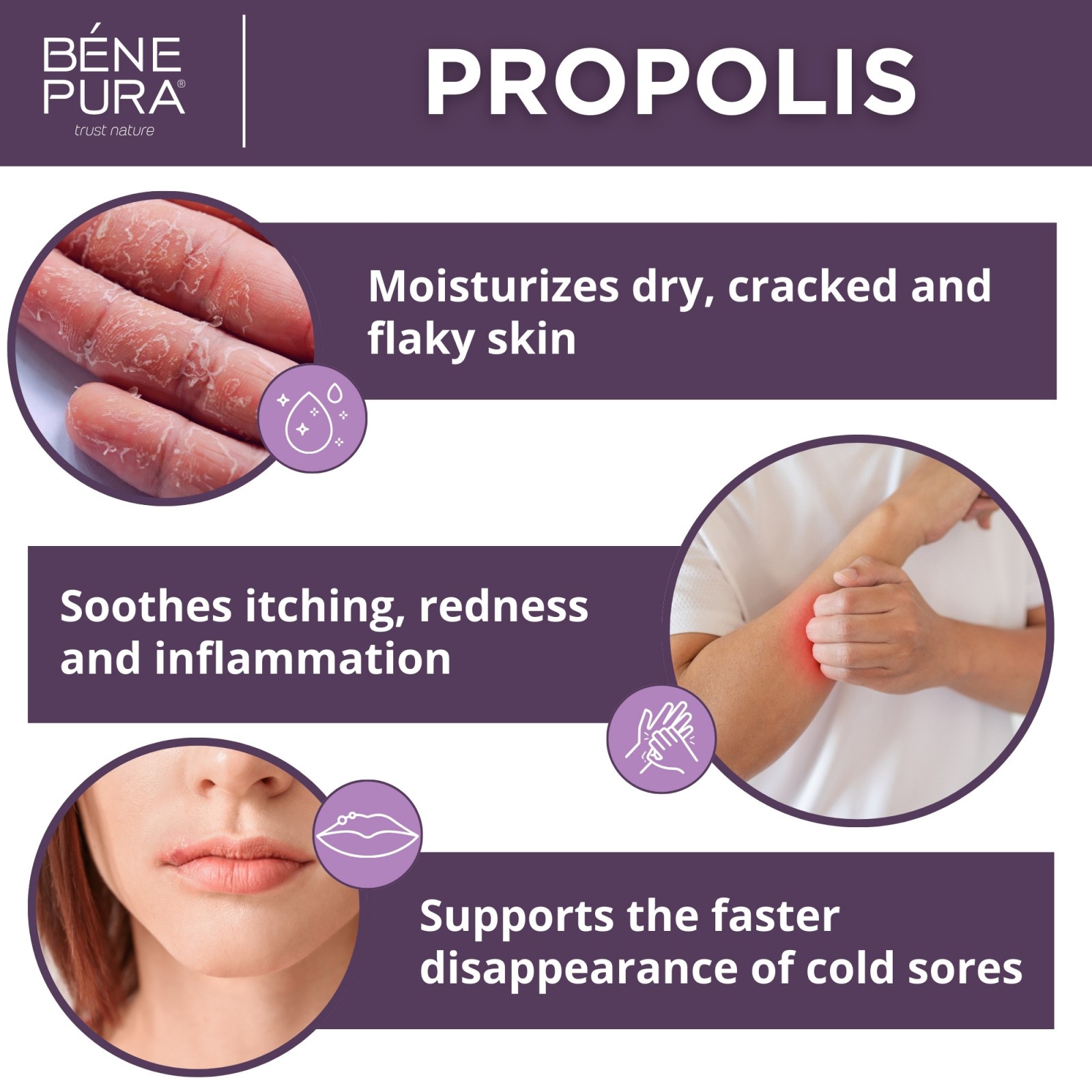 Chap Face ᐉ 2x Propolis ointment for Dry skin with 30% Propolis - 40ml - Benepura.com