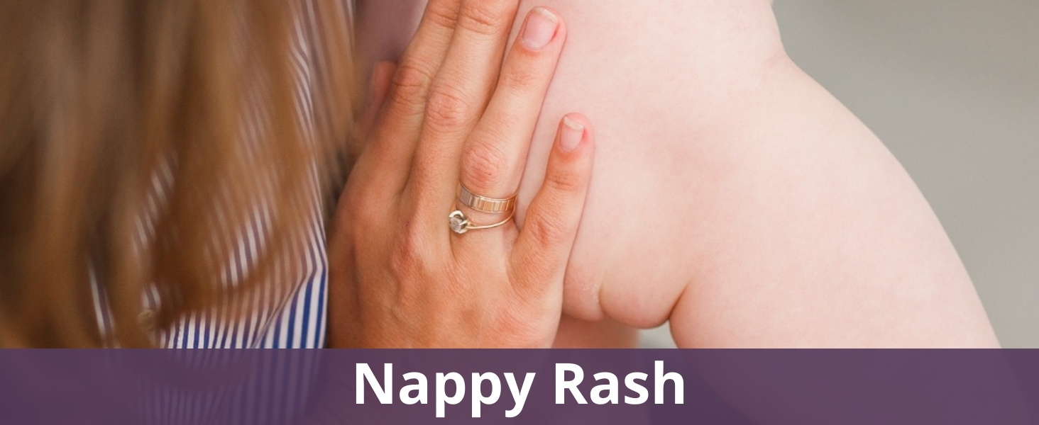 Nappy rash