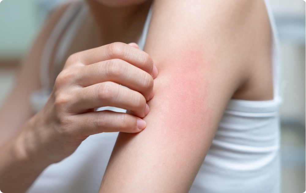 As an antiseptic and anti-inflammatory agent for irritations and minor wounds